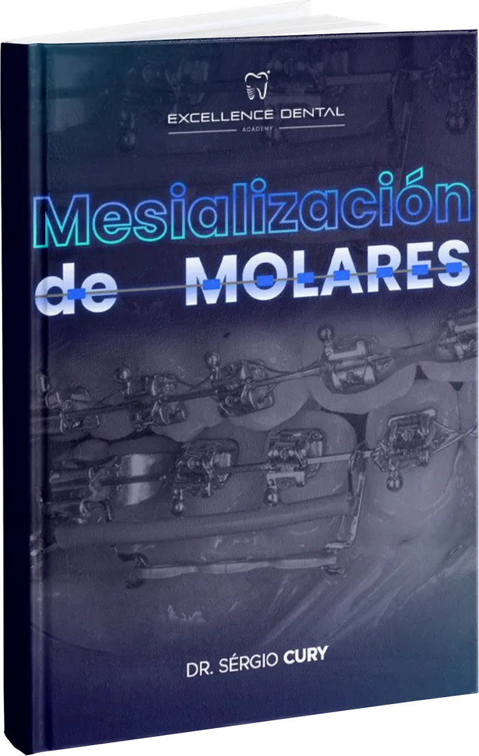 Manual de Mesialización de Molares